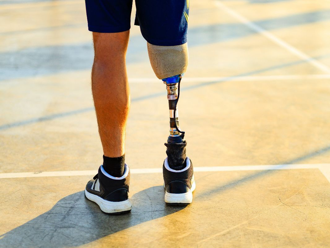 Hombre de pie con protesis de pierna